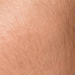 Duvet sur les joues